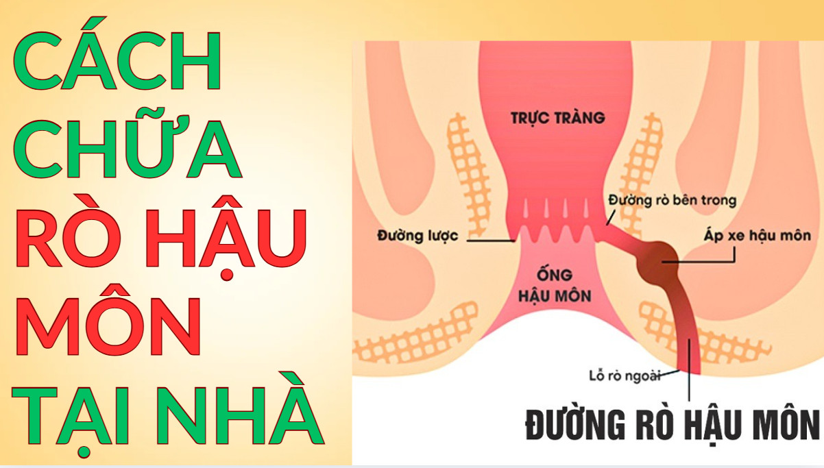 _images/cach-chua-ro-hau-mon-tai-nha.jpg