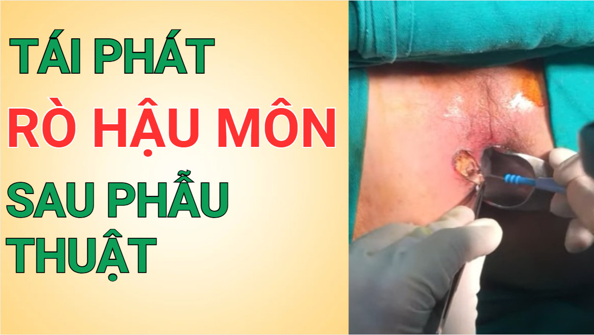 _images/tai-phat-ro-hau-mon-sau-phau-thuat.jpg
